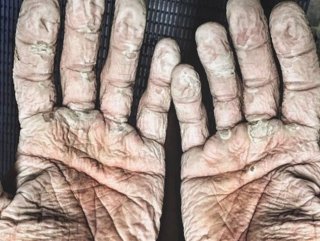 Dünya rekoru kıran Alex Gregory ellerini fotoğrafladı